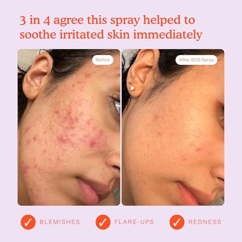 Tower 28 SOS Daily Rescue Facial Spray for Sensitive Skin, Hypochlorous Acid Spray Helps Visibly Reduce the Appearance of Redness and Breakouts, Travel Size Toner for Face, 1 FL Oz - Image 4